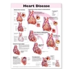 HEART DISEASE ANATOMICAL CHART [2E] LAMINATED