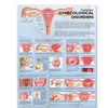 COMMON GYNECOLOGICAL DISORDERS ANATOMICAL CHART