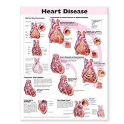 HEART DISEASE ANATOMICAL CHART [2E] LAMINATED