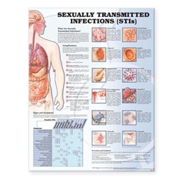 SEXUALLY TRANSMITTED INFECTIONS ANATOMICAL CHART [2E]